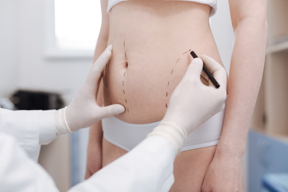 dr-ricardo-miranda-cirurgiao-plastico-hidrolipo-mini-lipo-lipoescultura-lipoaspiracao (1)